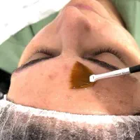 مدل برای اسیدتراپی