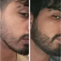 ریش امضای چهره مردونه