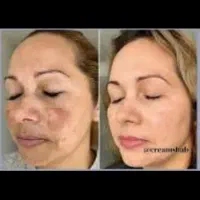 کرم معجزه اصل با گارانتی مرجوعی|آرایشی، بهداشتی، درمانی|سرپل ذهاب, |دیوار