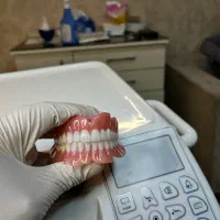 انجام دندان مصنوعی در پنج روز (تضمینی)