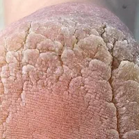 اموزش حرفه پدیکور خشک و خیس|خدمات آموزشی|یزد, |دیوار