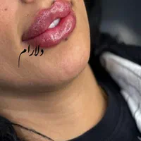ژل و بوتاکس - مدلنیگ عربی-آموزش حرفه ای|خدمات آرایشگری و زیبایی|شیراز, شهرک مهرگان|دیوار