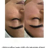 فیشال تخصصی و درمانی قم|خدمات آرایشگری و زیبایی|قم, زنبیل آباد|دیوار