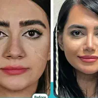 زیبایی بینی