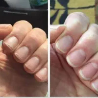 محلول تقویت ناخن و تقویت مو