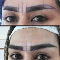 میکرو کاشت ابرو