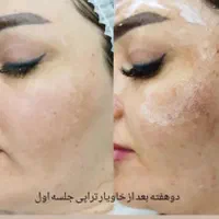 خاویارتراپی صورت و بدن|خدمات آرایشگری و زیبایی|مشهد, طلاب|دیوار