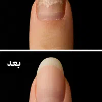 با کاشت ناخن خداحافظی کن