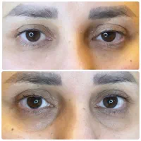 ژل لب روسی زاویه فک گونه چونه فیلرزیرچشم شقیقه نخ|خدمات آرایشگری و زیبایی|تهران, پاسداران|دیوار