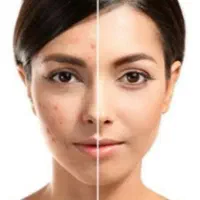 پوستت رو شاداب کن