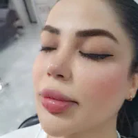 آنزیم بینی گوشتی پلاسما وپپرسینگ ،مزونیدلینگ