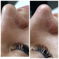 فیشال تخصصی.پاکسازی.کربوکسی.پلاژن تراپی.اسیدتراپی|خدمات آرایشگری و زیبایی|مشهد, انقلاب|دیوار