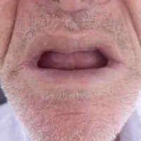 دندانسازی|آرایشی، بهداشتی، درمانی|فسا, |دیوار