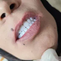 دندان مصنوعی وارداتی هر فک ۵ تومان|خدمات آرایشگری و زیبایی|کرج, کمالشهر|دیوار