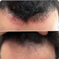 پوستتو مثل اینه کن