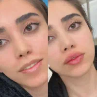 تخفیف به مناسبت روز مادر /ژل لب- کانتورینگ- بوتاکس|خدمات آرایشگری و زیبایی|مشهد, ایثار|دیوار