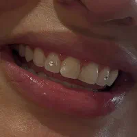 خدمات دندان پزشکی و دندان سازی|خدمات آرایشگری و زیبایی|زنجان, |دیوار