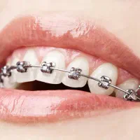 نیازمند بیماریاب ارتودنسی
