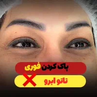 ریموو تاتو های صورت ابرو و چشم و لب در یک جلسه|خدمات آرایشگری و زیبایی|دزفول, |دیوار