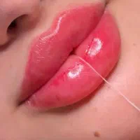 آموزش تزریق ژل و بوتاکس|خدمات آرایشگری و زیبایی|یاسوج, |دیوار