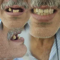 ( دندان سازی لبخند )|خدمات آرایشگری و زیبایی|زنجان, |دیوار