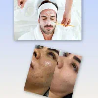 فیشیال تخصصی اقایان وبانوان در کلینیک زیبایی|خدمات آرایشگری و زیبایی|فردیس, قریشی|دیوار