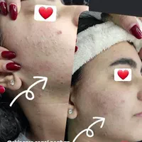 جشنواره پاکسازی و فیشیال پوست|خدمات آرایشگری و زیبایی|اصفهان, جلفا|دیوار