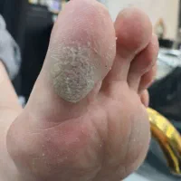 تخفیف ویژه اسپا،کفسابی،شفافیت کمتر از هرجافقط 250ت