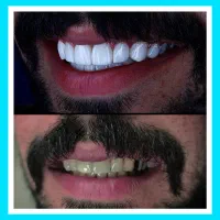 دندانپزشکی/کامپوزیت/ترمیم/عصبکشی ایمپلنت شرق و غرب|خدمات زیبایی و سلامت|تهران, تهرانپارس شرقی|دیوار