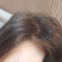 پروتز مو طبیعی