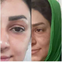 صابون لایه بردار گیاهی روشن کننده صورت وبدن|آرایشی، بهداشتی، درمانی|اهواز, آریاشهر|دیوار