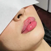 تخفیفات باور نکردین ژل،بوتاکس،آنزیم ،چال گونه|خدمات آرایشگری و زیبایی|کرمانشاه, |دیوار