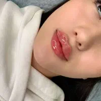 تخفیف یلدا کلینیک تزریق ژل بوتاکس،نخ لیزرتوسط پزشک