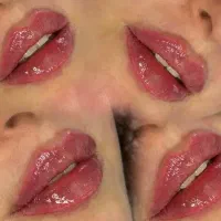 جشنواره ژل وبوتاکس