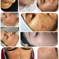 فیشال درمانی و تخصصی