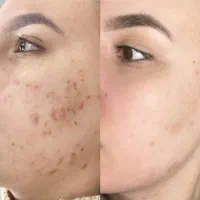 معجزه biommtic اصلی* با کارت ضمانت عودت وجه
