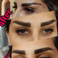 جشنواره تخفیف پی آر پی و ژل و بوتاکس|خدمات آرایشگری و زیبایی|شیراز, زرگری|دیوار