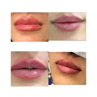 جشنواره پاییزی زیبایی در کلینیک ما آغاز شد...