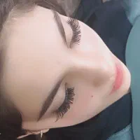 کاشت مژه هیدن
