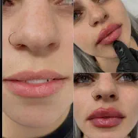 ژل لب،چونه ،آنزیم ،زاویه ،بوتاکس|خدمات آرایشگری و زیبایی|قم, تولید دارو و یخچال|دیوار