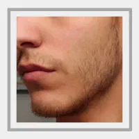 کاشت ممنوع