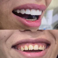 جشنواره دندانپزشکی اقساطی بدون پیش پرداخت|خدمات آرایشگری و زیبایی|شیراز, ستارخان|دیوار