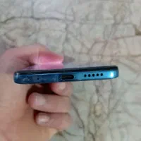 گوشی شیایومی نوت11 معمولی