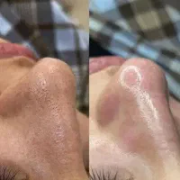 فشیال تخصصی و لاغری تضمینی