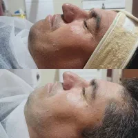 پاکسازی و فیشال تخصصی ویژه آقایان و بانوان