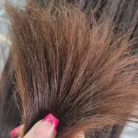موخوره گیری به روش روسی و اصلاح