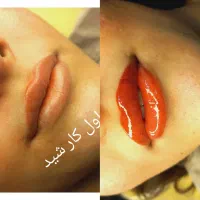 تتودائم صورت