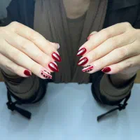 کاشت اولیه ناخن