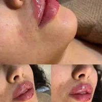 کارشناس ارشد مامایی آماده همکاری هستم