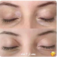 درمان قطعی و بدون بازگشت مشکلات پوستی|خدمات آرایشگری و زیبایی|مشهد, کلاهدوز|دیوار